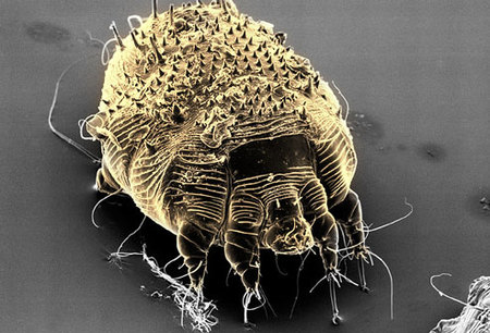 Photolibrary Rf Photo Of Scabies Mite